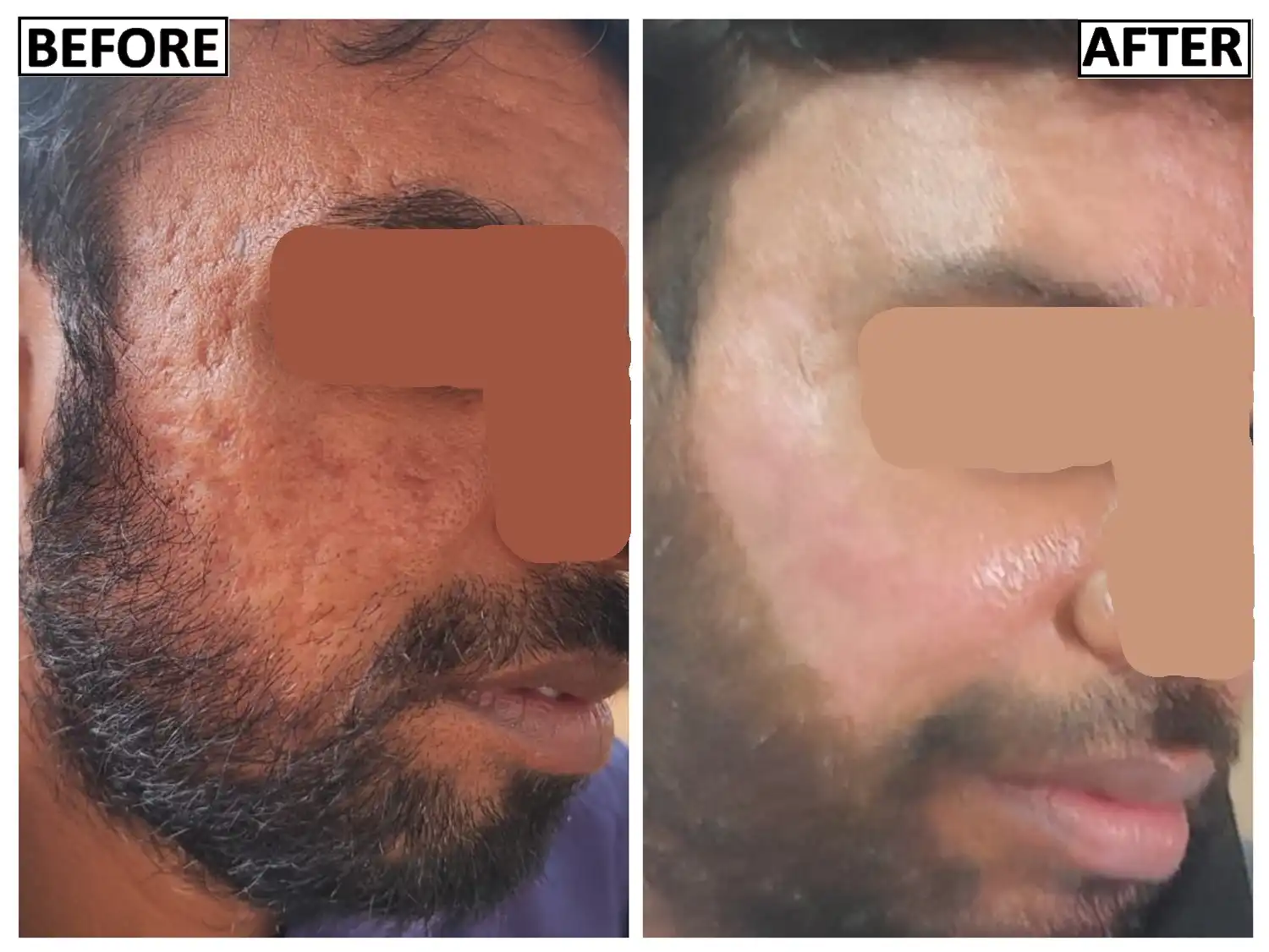 Treatment showcase image 7